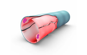 Circulation Is Just As Important As Blood Sugar In Diabetes